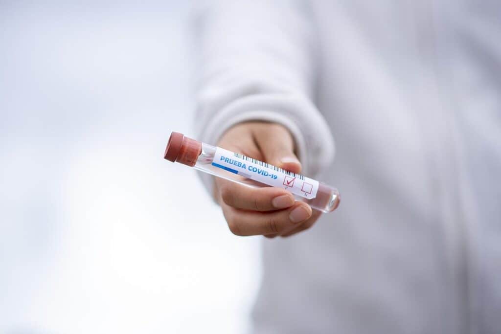 PCR test