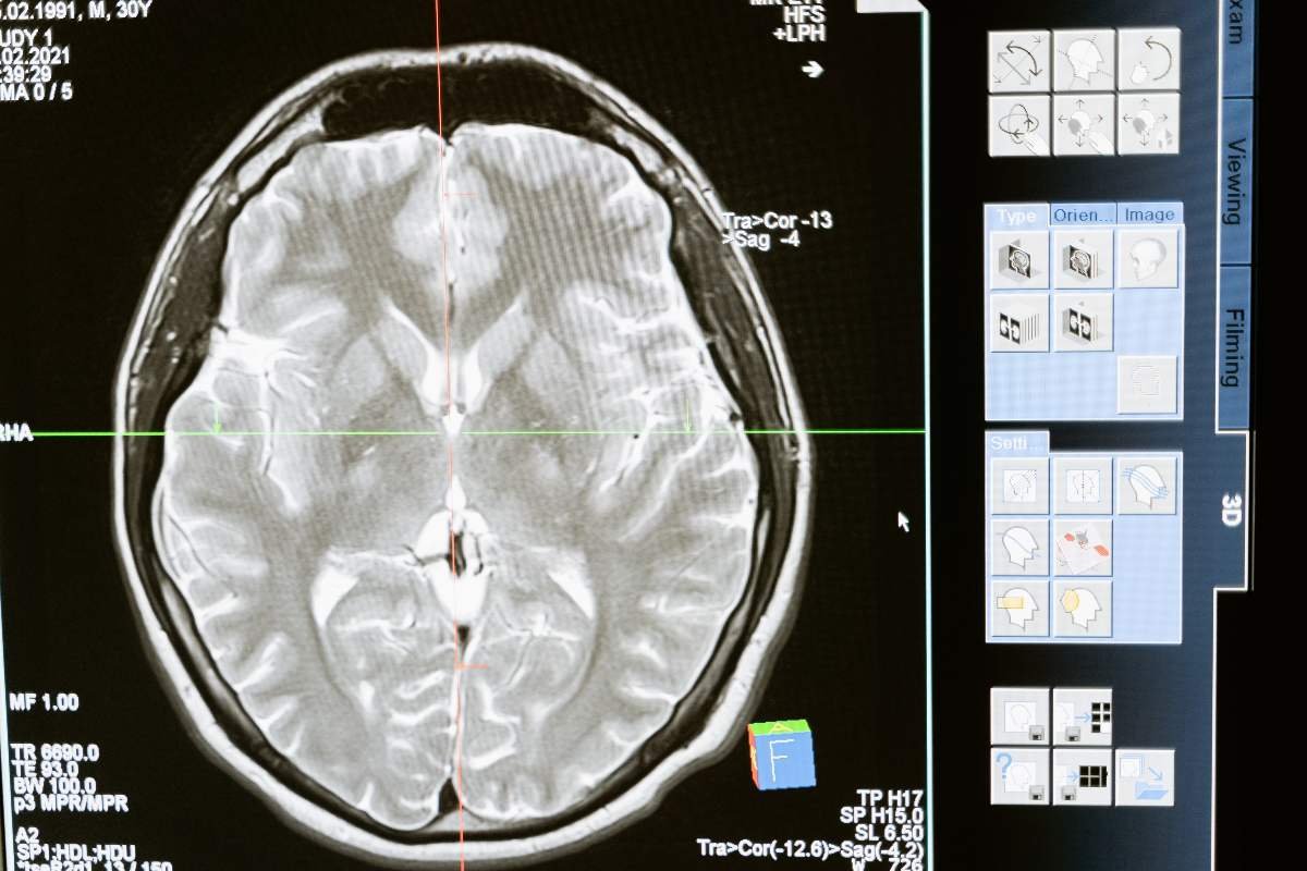 Algoritmo cerebro